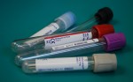 Εξεταστείτε δωρεάν για HIV και ηπατίτιδες